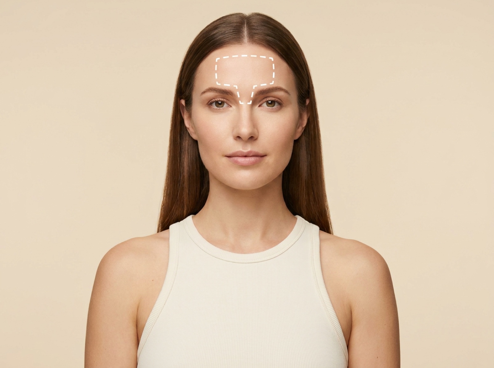 Glabella