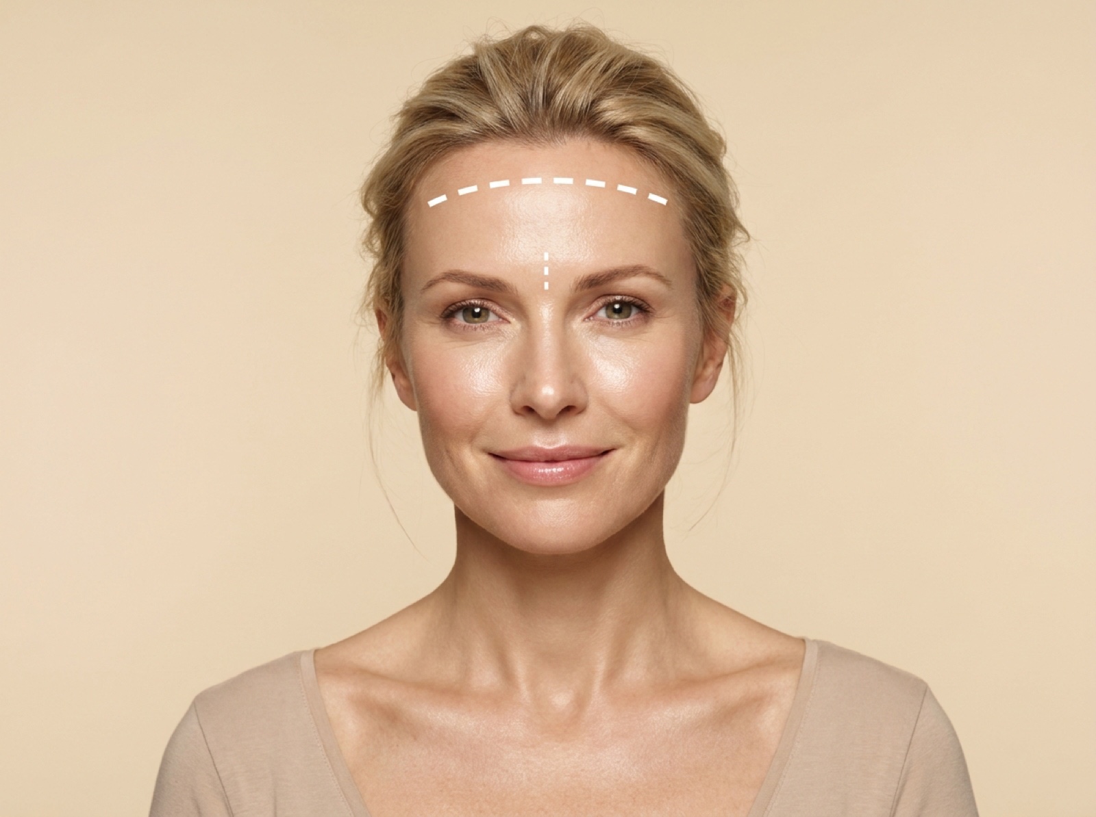 Botox