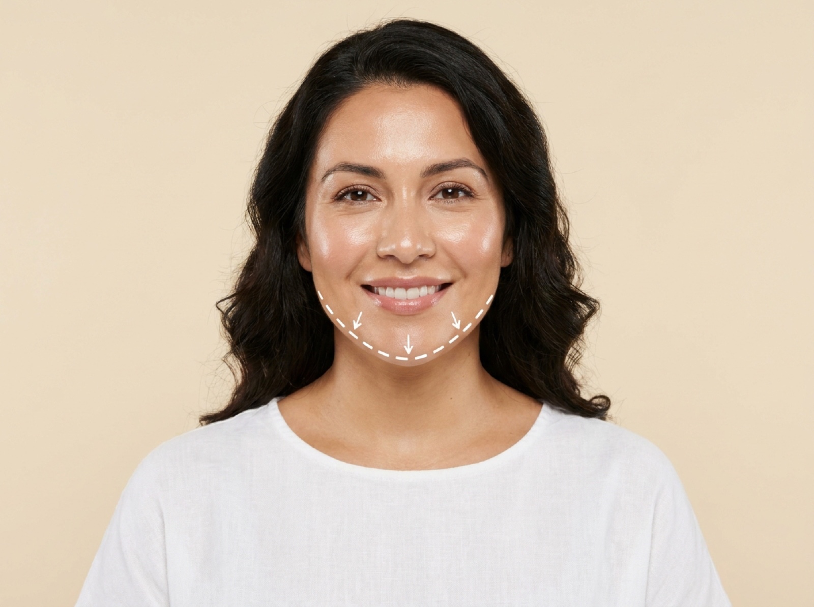Chin Filler