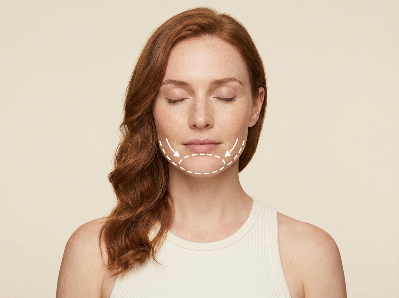 Face Skin Tightening — Chin