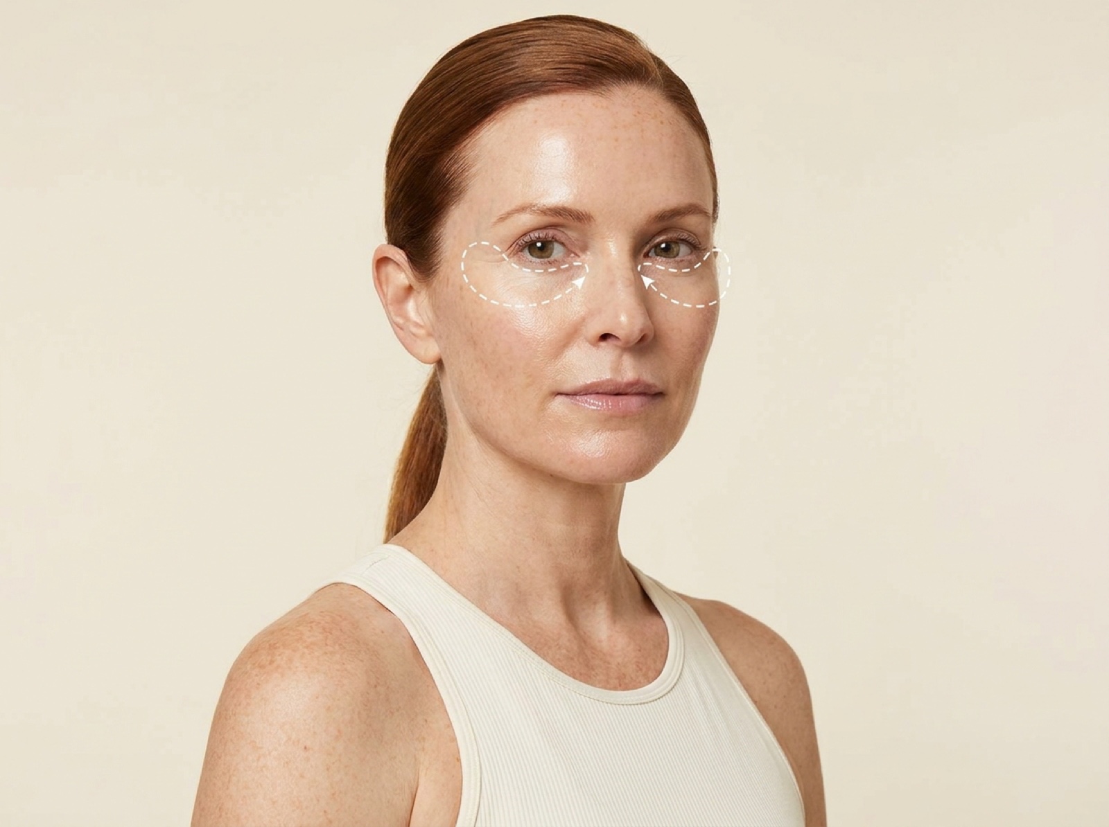 Face Skin Tightening — Eyes