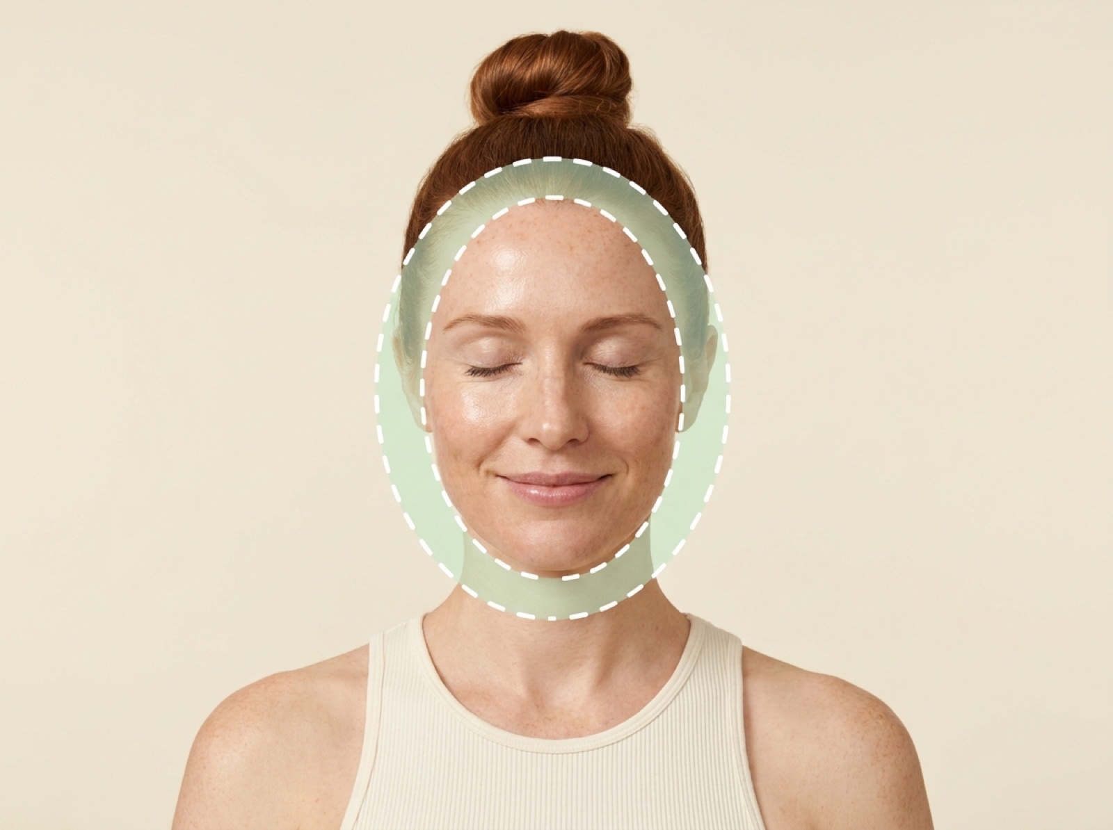 Green Peel