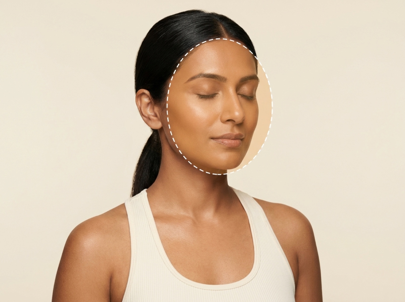 Medical Peel — Jessner Peel