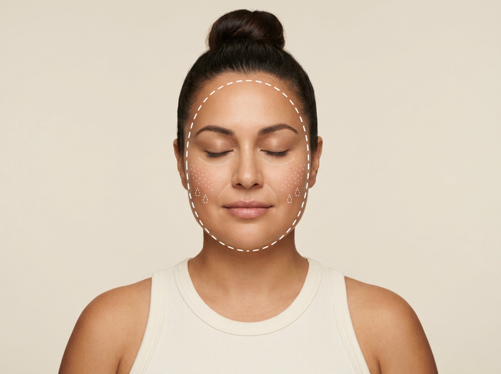 Microneedling + Glycolic