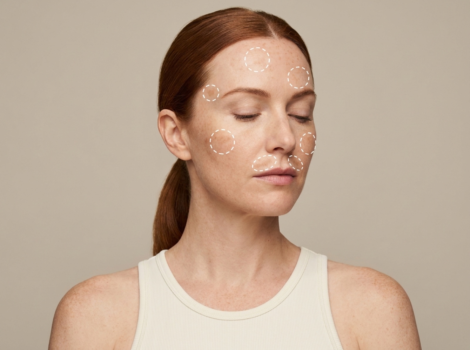 Pigmentation Laser — Face