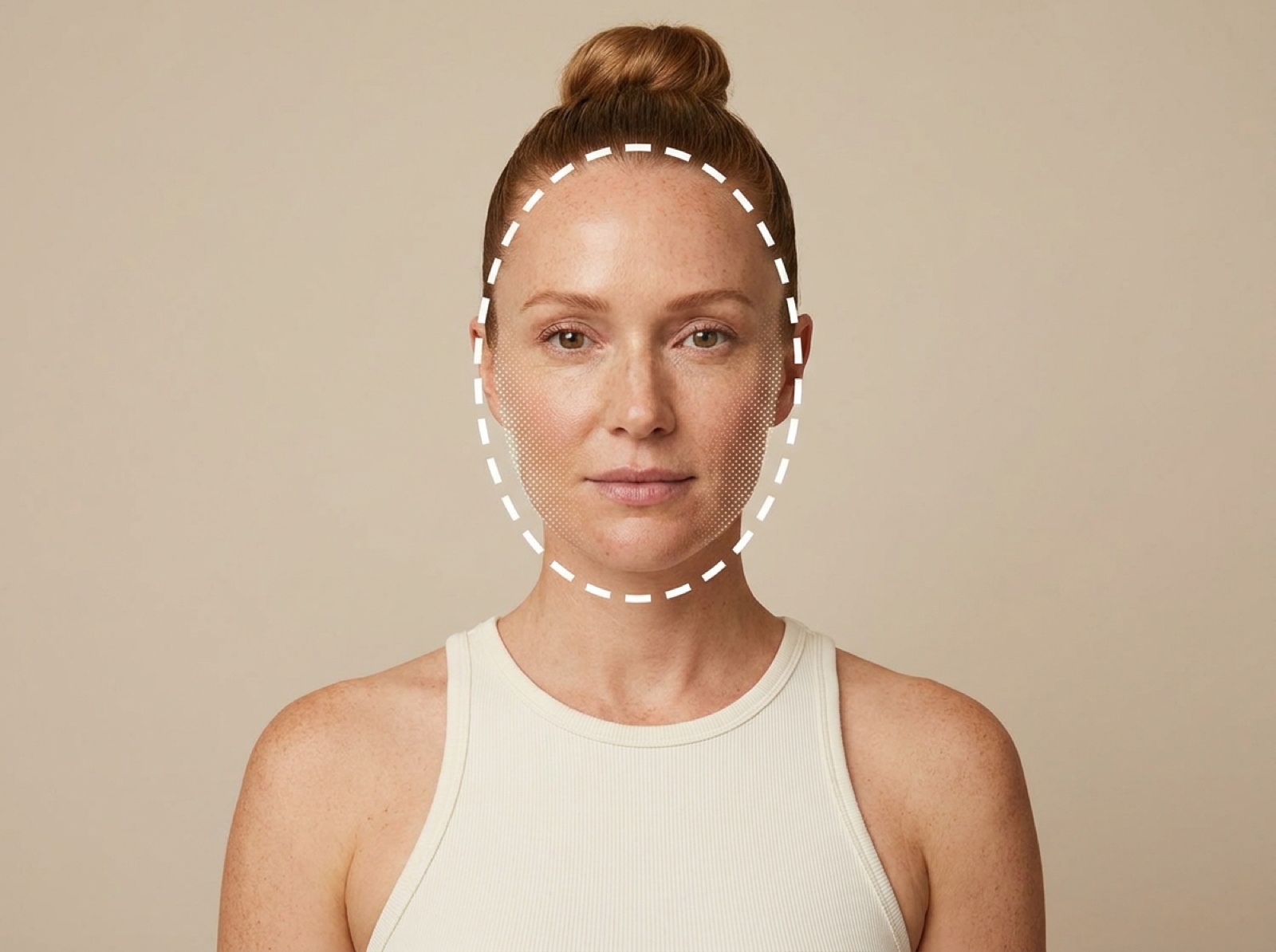 Skin Resurfacing