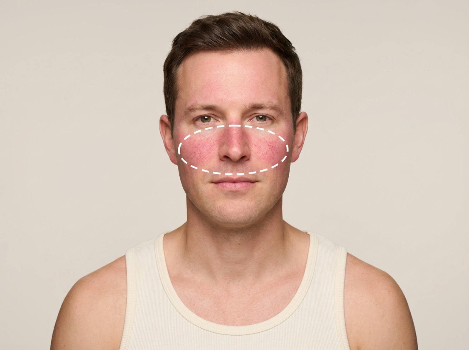 Vascular Laser